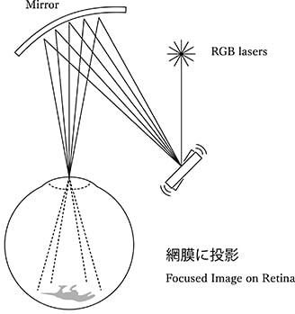 Illustration of RETISSA system