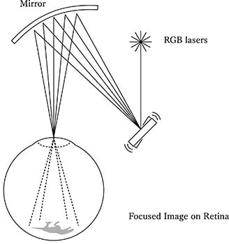 Illustration of RETISSA system